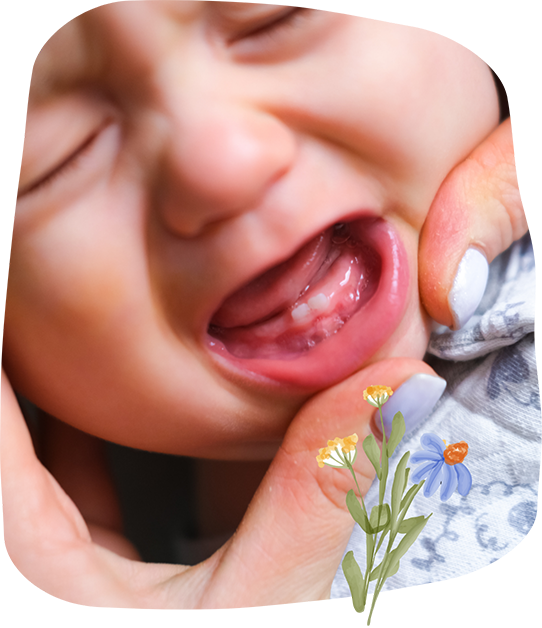 Dentist looking at a crying baby's mouth