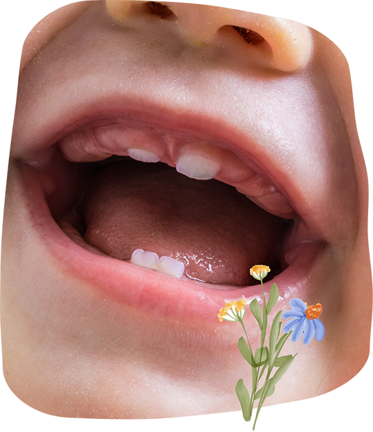 Close up of a toddler's mouth with a few teeth beginning to erupt